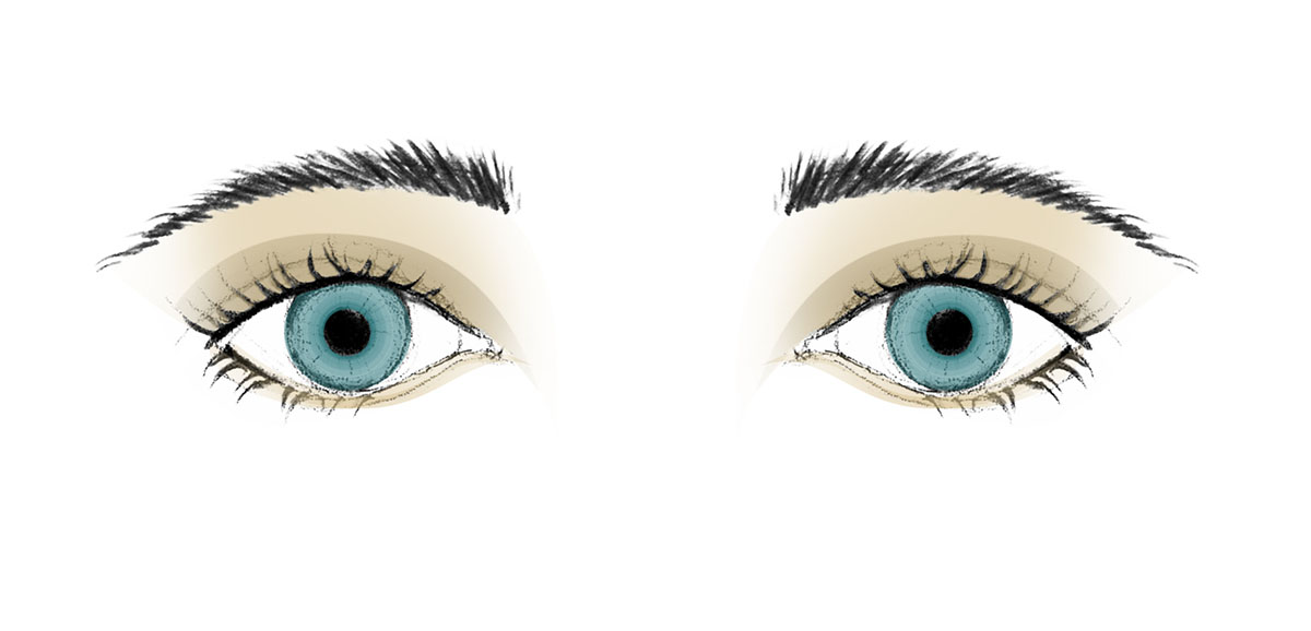 Abfallende Augenbrauen